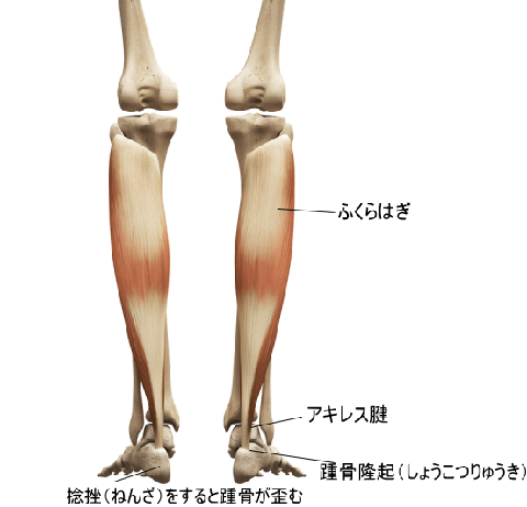 捻挫の後遺症 アキレス腱へ及ぼす影響 横浜で鍼灸と言えばオリンピック選手や世界選手権金メダリストも通う土井治療院へ