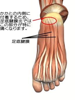 足底筋膜図1