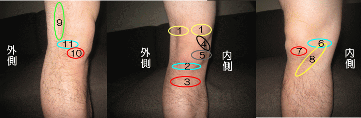 スポーツによる膝痛の施術風景2