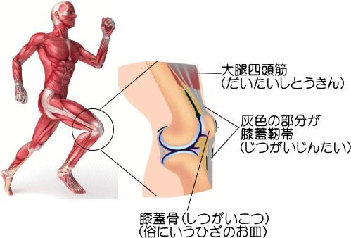 ジャンパー膝の詳細図1