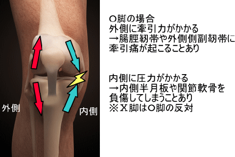 膝内側の痛みの原因とは 横浜で鍼灸と言えばオリンピック選手や世界選手権金メダリストも通う土井治療院へ