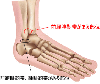 前 脛 腓 靭帯